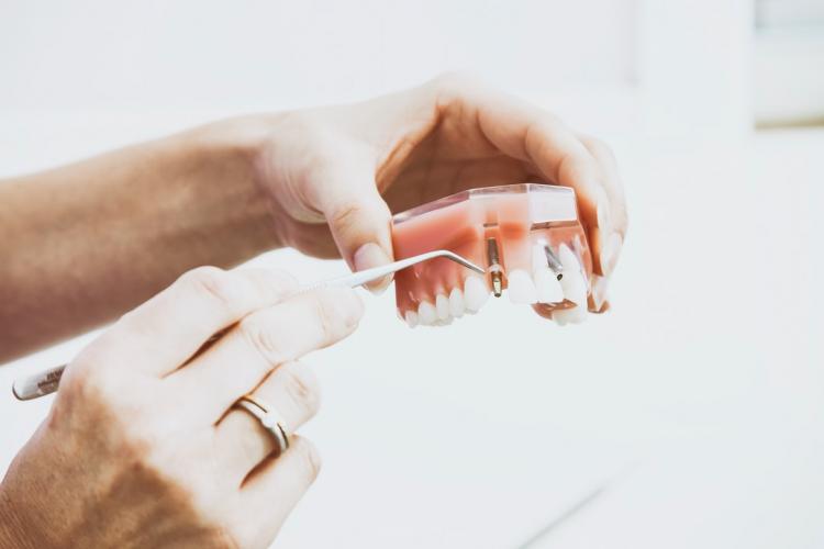 Które implanty zębowe będą dla nas najlepsze: tytanowe czy cyrkonowe?